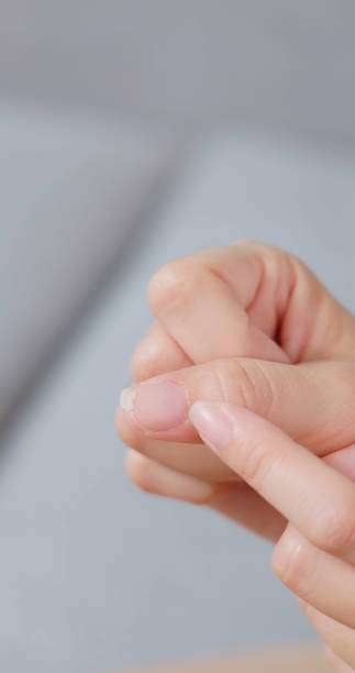 istock Woman touching her cracked fingernail 2205352217