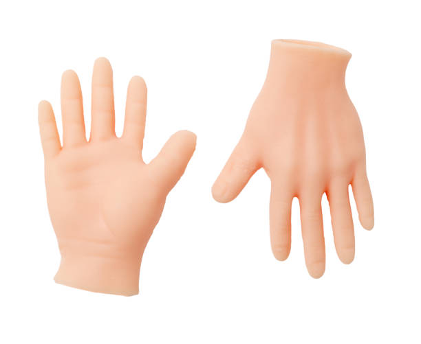 istock Two hands are shown, one of which is missing fingers 2205467523