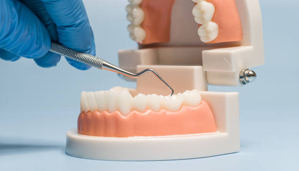 istock Dental model with scaler tool for teeth cleaning demonstration 2205479458