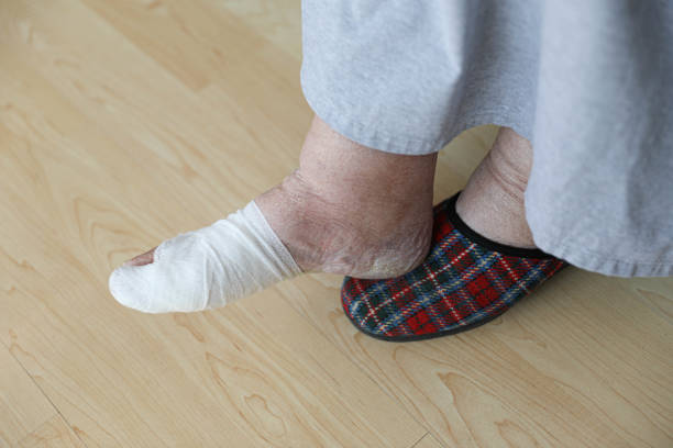 istock Healing Process: Elderly Woman’s Wrapped Toe in Pain 2205526721