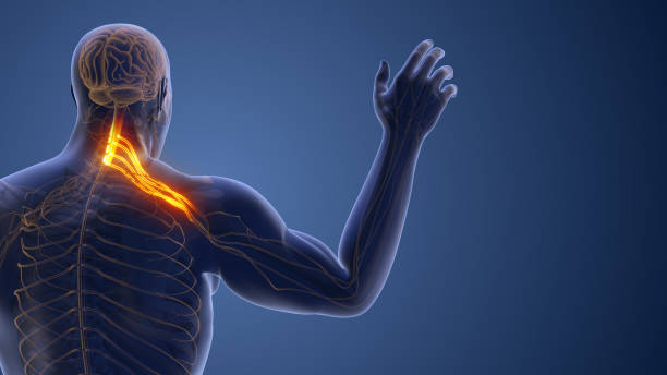 istock Compressed Cervical Nerve Leading to Radiating Pain 2205527403