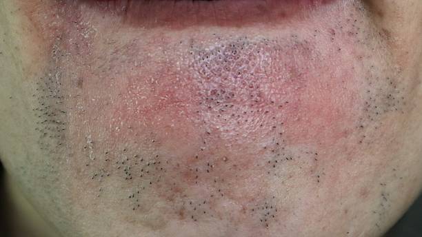 istock A Japanese man whose beard has thinned due to hair removal 2205527669