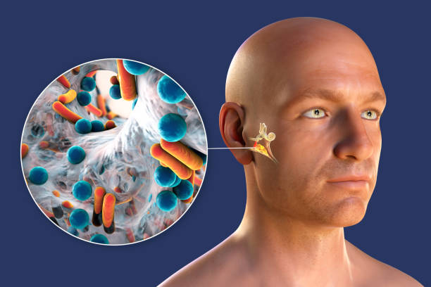 istock Otitis media ear infection, illustration 2205701323