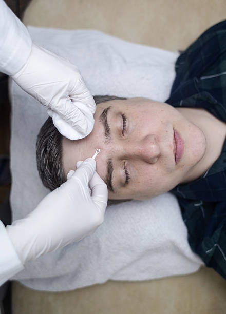 istock Man undergoing facial cleansing and blackhead removal. Beautician using comedone extractor or uno loop. Professional skin care in a beauty salon 2205714561
