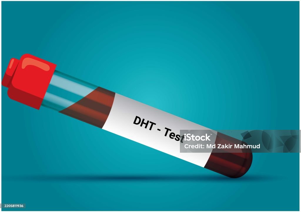 Blue Dht Blood Sample For Dht Hormone Test Stock Illustration - Download Image ...