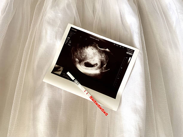 istock Expecting a new arrival - ultrasound and pregnancy test 2205821710