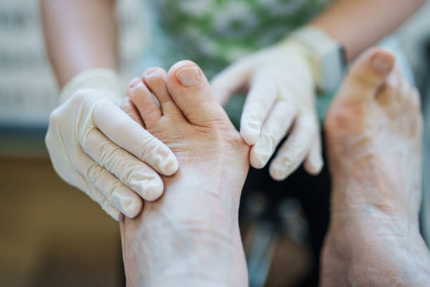 Twisted swollen adult ankle on a white sheet
