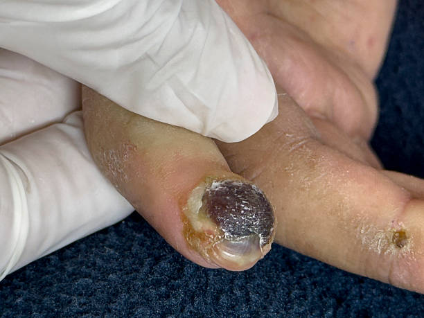 Medical themes: Close up of female patient with scleroderma