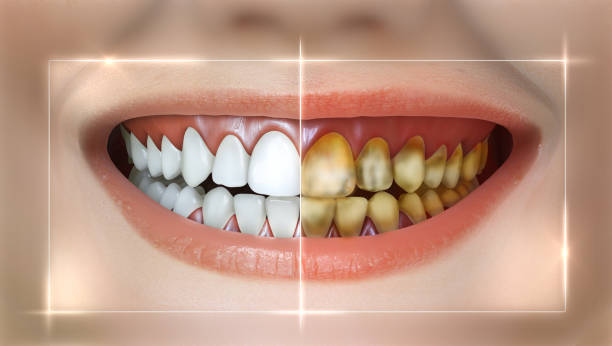 Good Teeth Example 70+ Exposed Teeth Stock Photos, Pictures & Royalty-Free Images - iStock