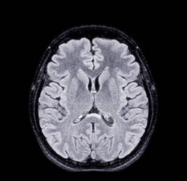 通常の人間の脳の解剖学の Mri - MRI検査のストックフォトや画像を多数