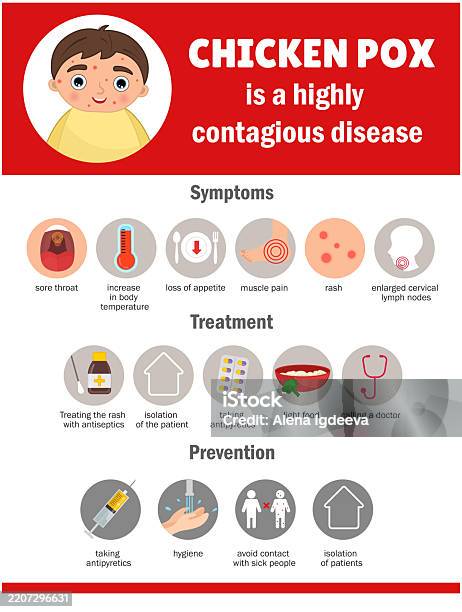 Chickenpox Graphics Vector Infographics Chickenpox Stock Illustration - Download Image Now ...