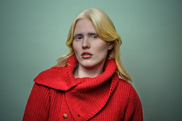 istock Albino model in vibrant red sweater posing against a soft green background 2207357863