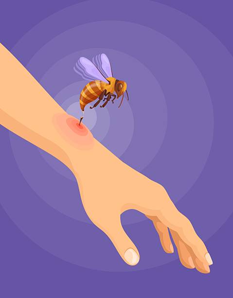 Bee sting. Bees wasp hornet bumblebee bites on skin danger allergy, flying bug insect with dangerous stinger prickle attack emergency medical first aid, neat vector illustration Bee sting. Bees wasp hornet bumblebee bites on skin danger allergy, flying bug insect with dangerous stinger prickle attack emergency medical first aid, neat vector illustration original artwork hornet swarm stock illustrations