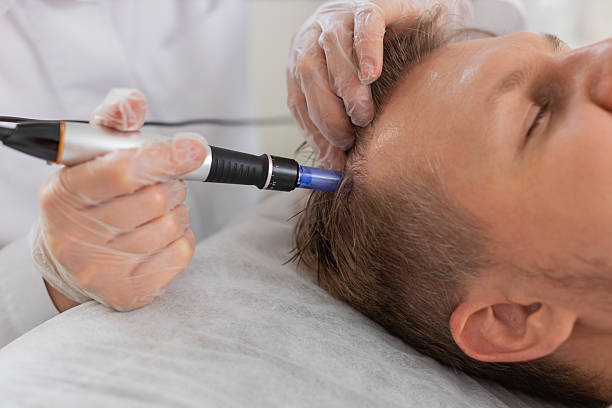 istock Trichologist doing man improve hair growth procedure, dermapen microneedling, vitamin injections 2207557193
