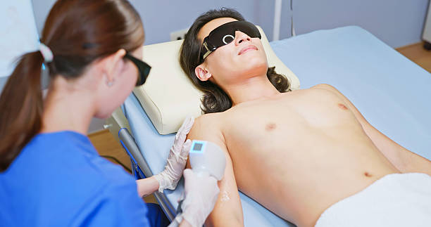 istock male laser arm hair removal 2207576864