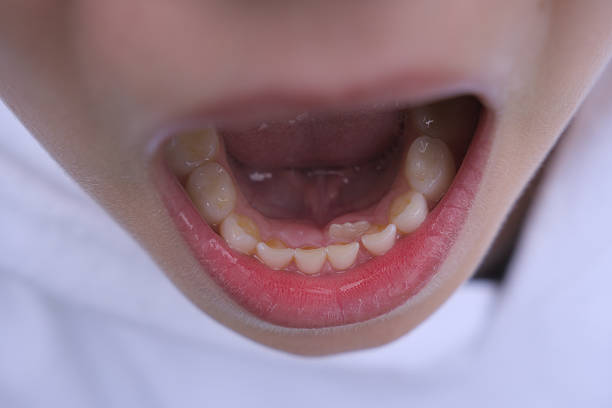 Dental model displays realistic teeth and gums for anatomy study.
