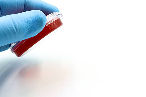 A scientist's or researcher's hand taking a microbiological sample from a surface. Disinfection. Food safety.