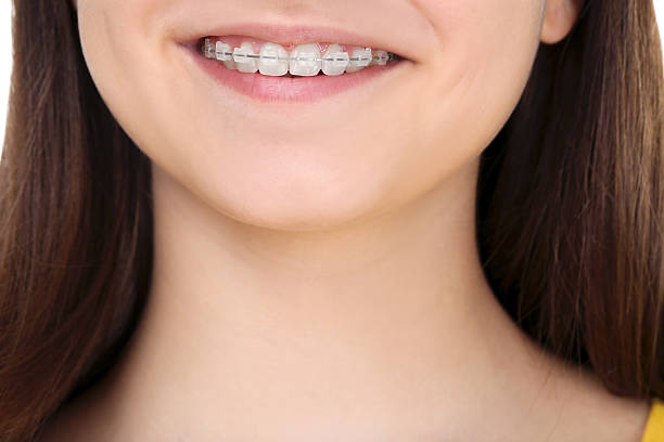 istock Young girl with dental braces 2208340021