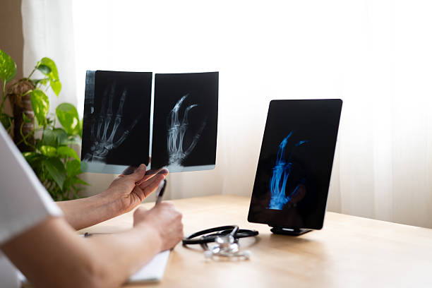 istock Doctor holding and examining hand x-rays, comparing them with digital image on tablet, taking notes during a medical consultation, diagnosing a possible fracture 2208598245