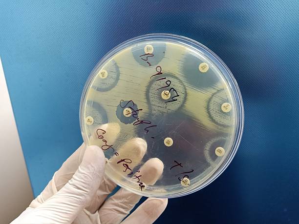 istock Culture Petri dish background. 2208672974