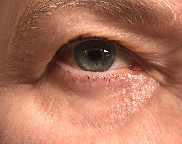 istock Senior Woman Eye Selfie 2208873146