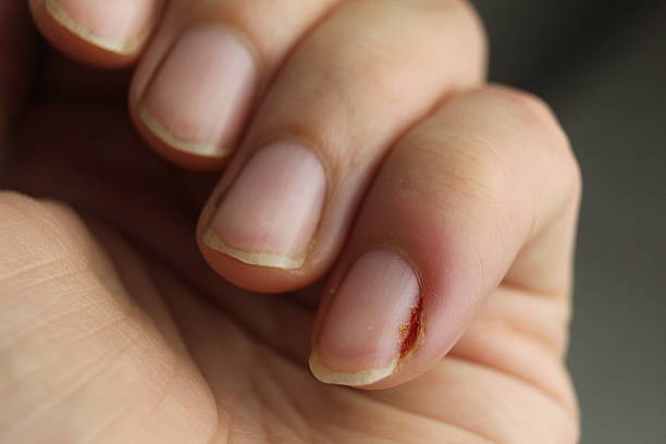 istock Close-up of a woman's hand nails without manicure. Clean hands 2209124759
