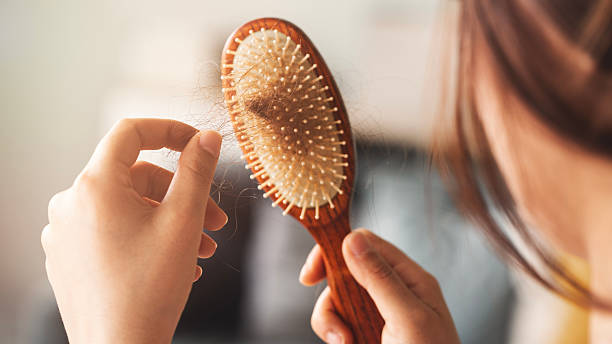 istock Hair loss and alopecia concept 2209221775