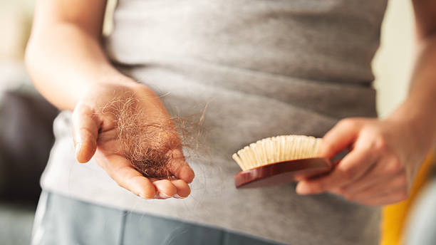 istock Hair loss and alopecia concept 2209307613