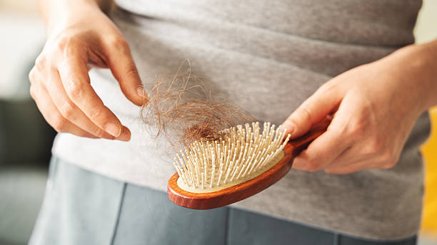 istock Hair loss and alopecia concept 2209307619