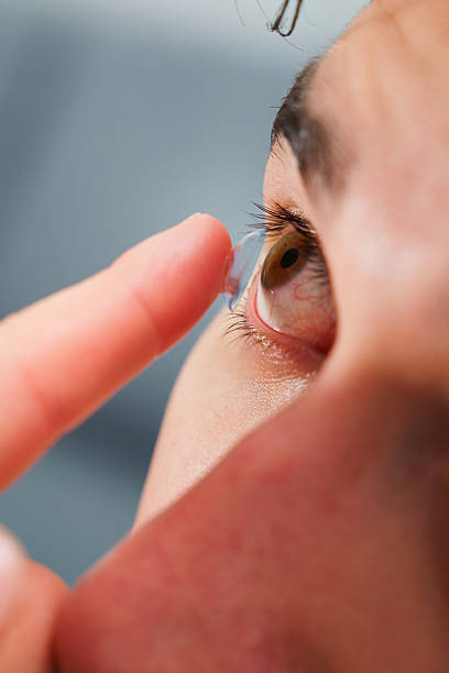 istock Man inserts a contact lens into eye for myopia treatment. Correcting eye wellnesses with optical contact lenses. 2209412314