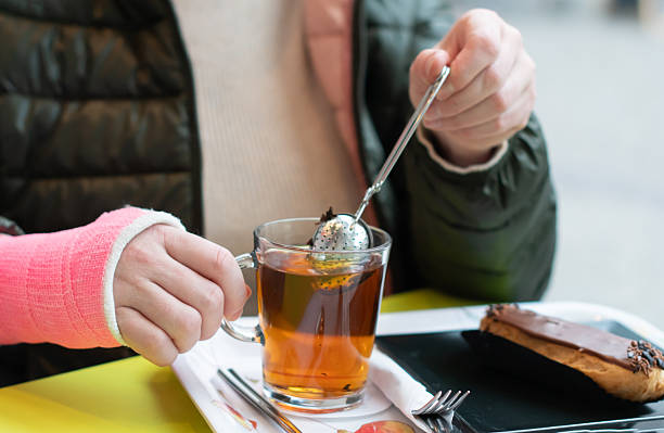 istock woman with a pink plaster cast on her right arm sits in a cafe and drinks tea with eclair, active life 2209467327