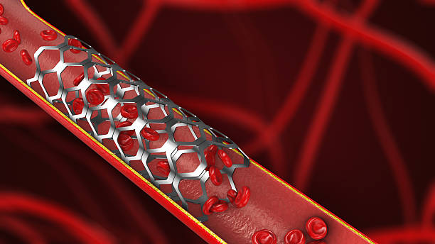 istock Artery Blockage Treatment with Blood Cells Flow 2209673776