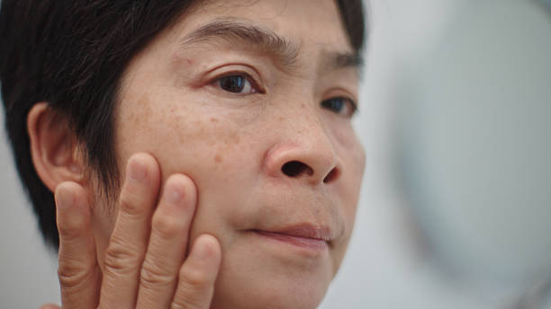 istock Worried mature woman looking at skin problems. 2210020774