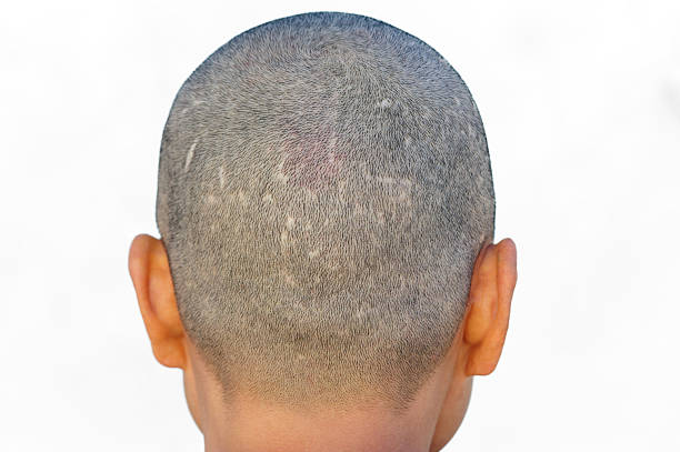 A dark, almost black, silhouette of a human head in profile, set against a textured red background with visible cracks. This image conveys concepts of thought, mind, mental health, challenges, and inner struggles, suitable for psychological themes, stress, and abstract human conditions.