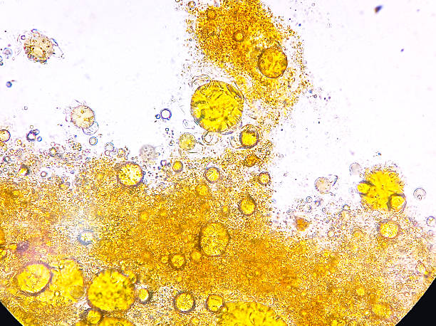 istock Microscopic image of stool Mucus and fat Globules. 2210327399