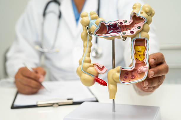 istock Intestine, appendix and digestive system, doctor holding anatomy model for study diagnosis and treatment in hospital. 2210377480