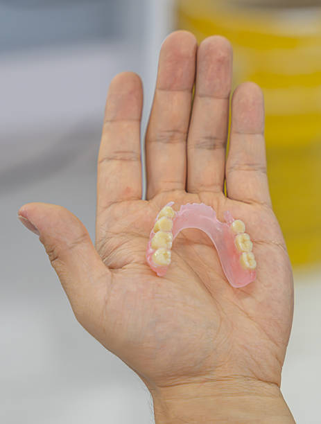 istock Dental Prosthetic Model on a hand. Detailed dental model 2210490995