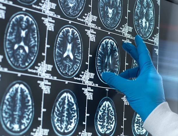 istock A medical professional examines brain scans, a key tool in modern medical diagnostics and neurology. 2210941093