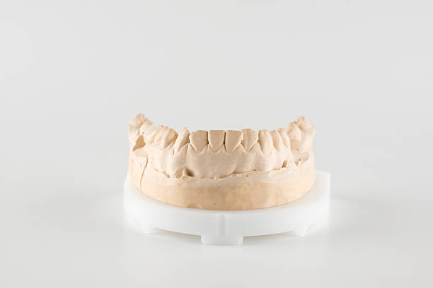 dental crown made of ceramics is located on a white background