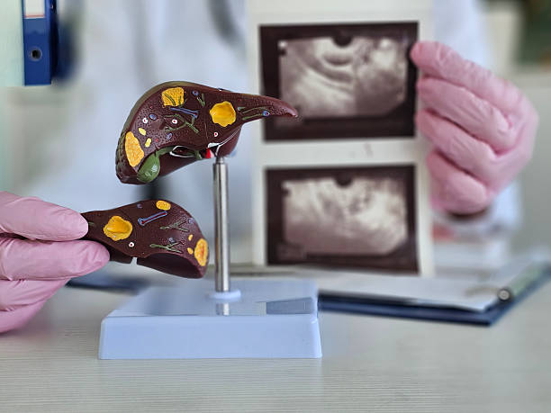 istock Medical professional examines liver model while referencing ultrasound images 2211529619