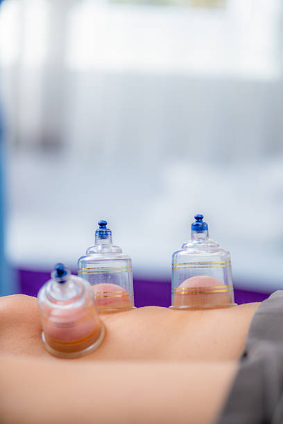 istock Cupping therapy on the knee enhances circulation during a physical therapy session for a woman. 2211705539