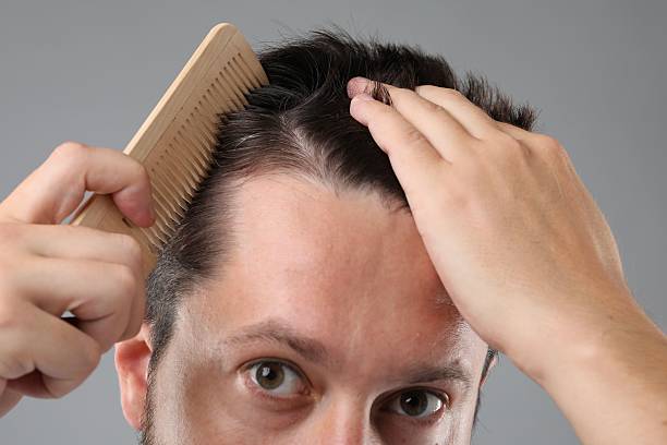 istock Man brushing his hair on gray background, closeup. Alopecia problem 2211723643