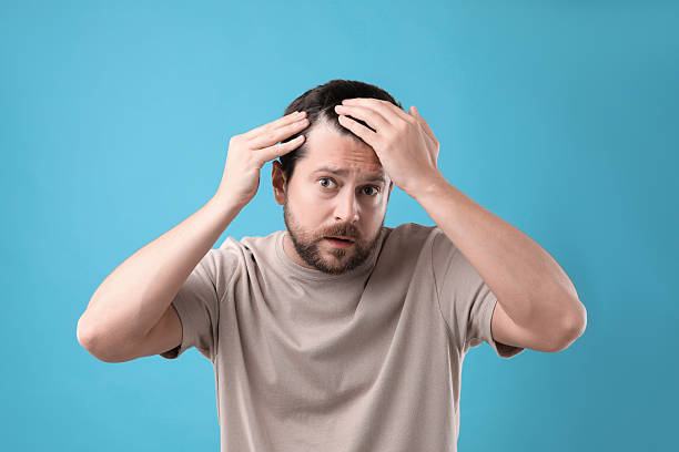 istock Man with hair loss problem on light blue background, space for text 2211723646
