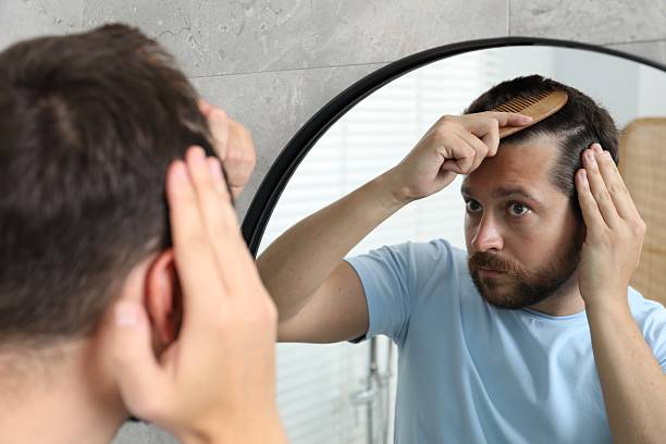 istock Man brushing his hair near mirror indoors. Alopecia problem 2211723669