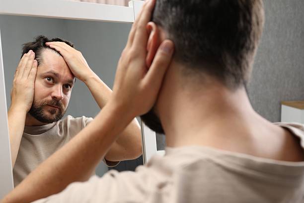 istock Man with hair loss problem looking at mirror indoors 2211723676