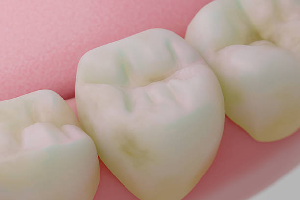 istock tooth With Yellow and Brown Stains Showing Matte Surface 2211733762