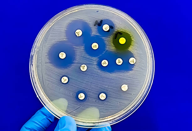istock Antimicrobial susceptibility testing in petri dish. Petri dish in Microbiologist hand with blue background. 2211951928