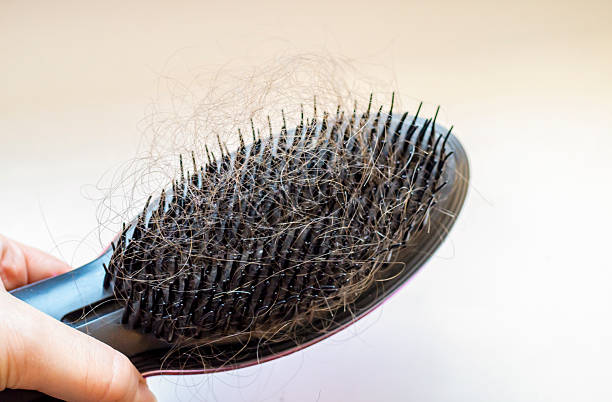 istock Lost hair on a comb on a light background 2212118031
