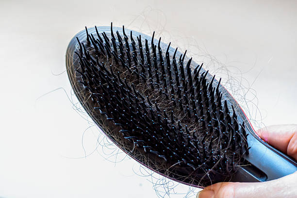 istock Lost hair on a comb on a light background 2212118034