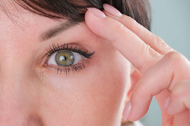 istock The woman has a drooping eyelid 2212329699
